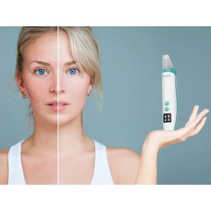 Beper - Nettoyeur de pores rechargeable USB/5V 400 mAh