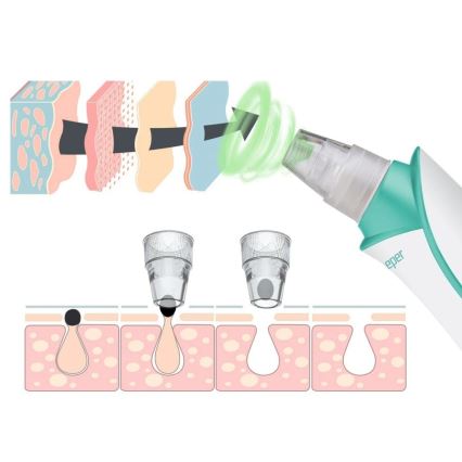 Beper - Nettoyeur de pores rechargeable USB/5V 400 mAh